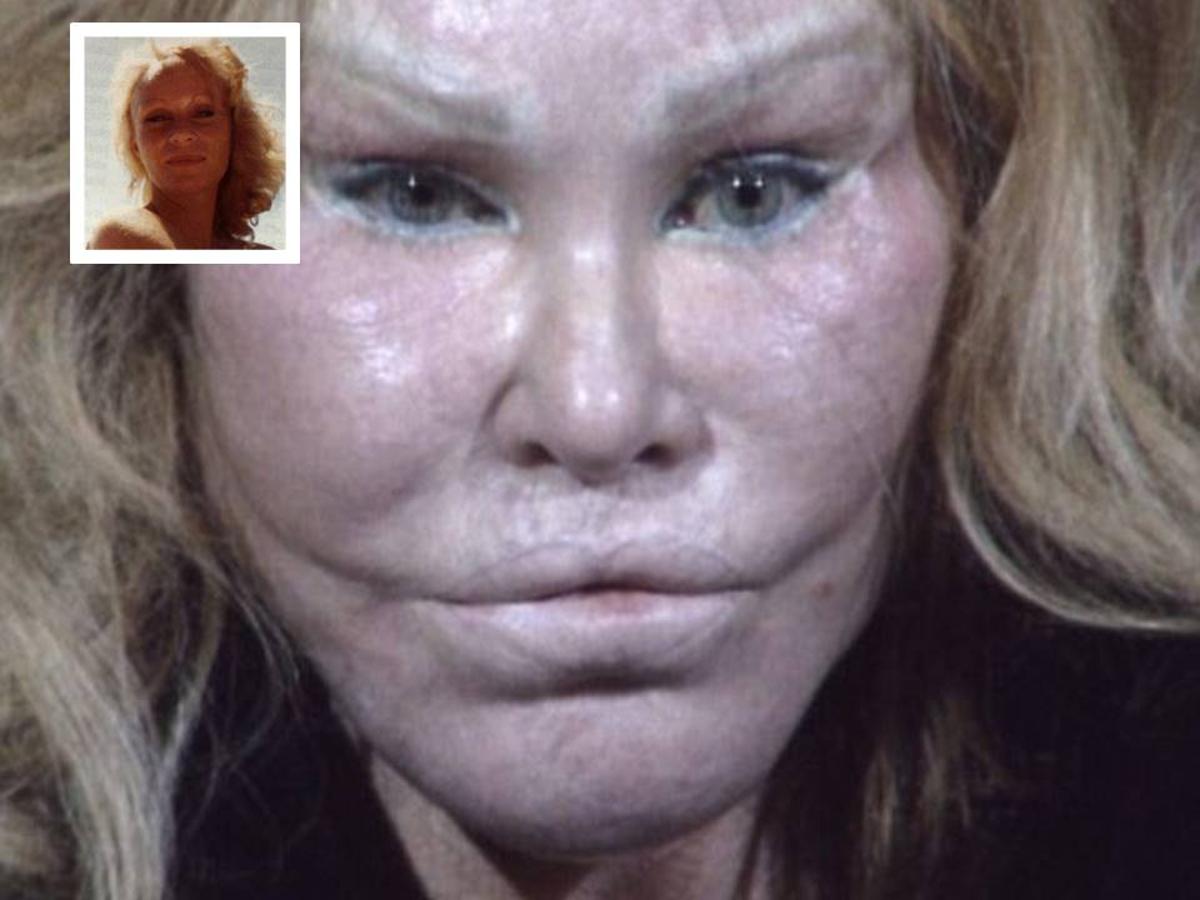 Cirugía estética: antes y después Jocelyn Wildestin