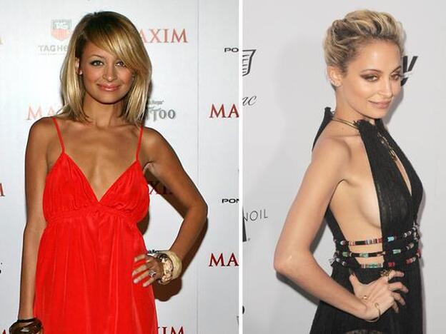 Nicole Richie pasó de tener el pecho caído y poco firme en 2005 a lucir así de redondeado y levantado en la actualidad./Cordon Press