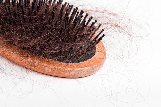 Caída del pelo/Fotolia