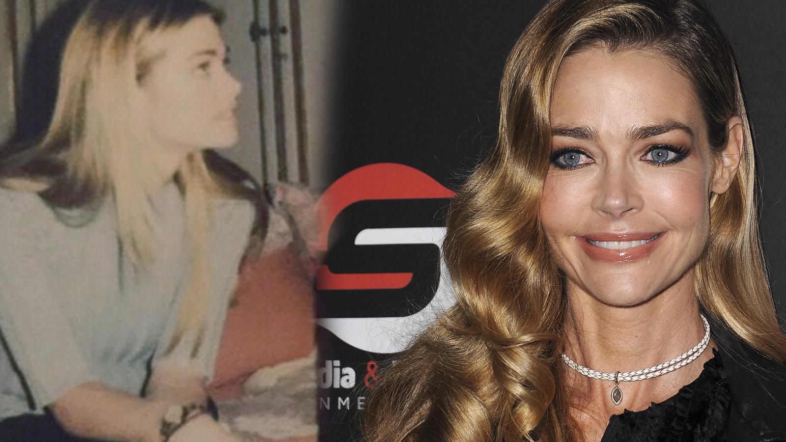 Famosas de niñas: Denise Richards, cambiada por la cirugía