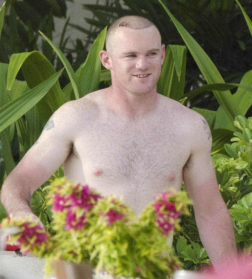 Wayne Rooney, recién transplantado de pelo en 2011
