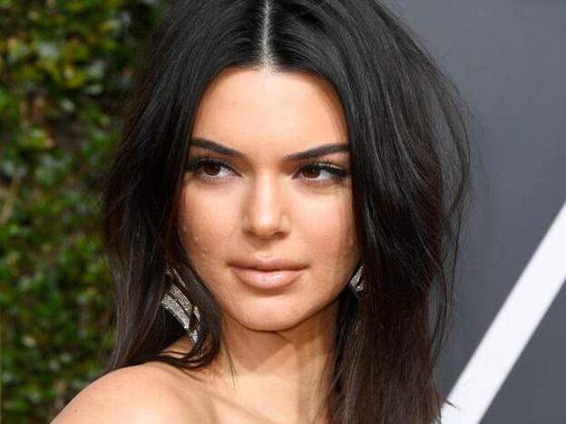 Kendall Jenner y su acné./getty