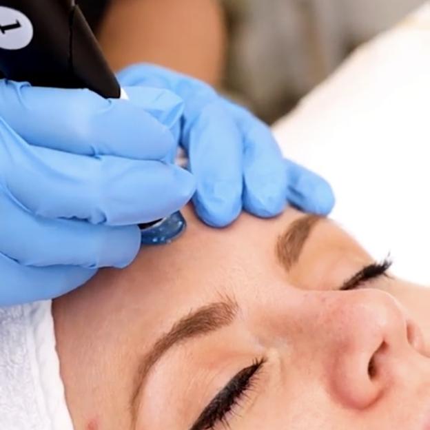 Hydrafacial Syndeo™ en Maribel Yébenes.